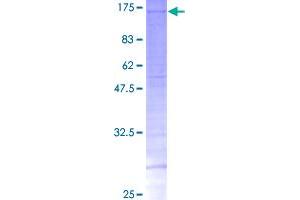Image no. 1 for SFRS Protein Kinase 2 (SRPK2) (AA 1-689) protein (GST tag) (ABIN1321346)