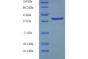 SDS-PAGE (SDS) image for Cysteine-Rich Protein 2 (CRIP2) (AA 1-208), (full length) protein (His-SUMO Tag) (ABIN5709327)