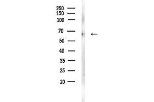 anti-Coagulation Factor IX (F9) (C-Term) antibody