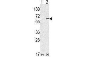 Western blot analysis of anti-hSPHK1-M1 Pab in 293 cell line lysates transiently transfected with the SPHK1 gene (2 µg/lane).