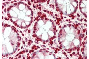 Rabbit Anti-SMARCE1 antibody Catalog Number: ARP33313 Formalin Fixed Paraffin Embedded Tissue: Human Colon Primary antibody Concentration: 1:100 Secondary Antibody: Donkey anti-Rabbit-Cy3 Secondary Antibody Concentration: 1:200 Magnification: 20x Exposure Time: 0.