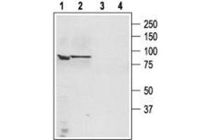 Western blot analysis of human PC3 Caucasian prostate adenocarcinoma (lanes 1 and 3) and human LNCaP prostate carcinoma (lanes 2 and 4) cell lysates: - 1,3. (TRPC4 anticorps  (C-Term, Intracellular))