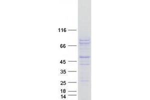 Validation with Western Blot