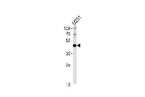 X6 Antibody (Center) (ABIN390916 and ABIN2841118) western blot analysis in  cell line lysates (35 μg/lane). (PAX6 anticorps  (AA 183-210))