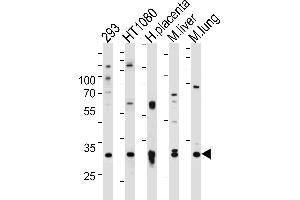 Western blot analysis of lysates from 293,HT1080 cell line,human placenta,mouse liver and lung tissue (from left to right),using SAR1A Antibody . (SAR1A anticorps  (AA 122-149))