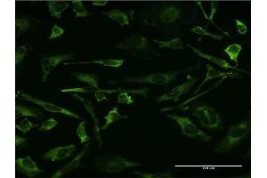 Immunofluorescence of monoclonal antibody to MAPK8 on HeLa cell.