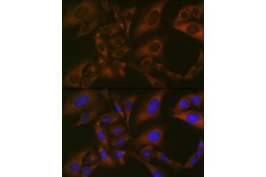 Immunofluorescence analysis of U-2 OS cells using BMP6 Rabbit mAb (ABIN7265900) at dilution of 1:100 (40x lens). (BMP6 anticorps)