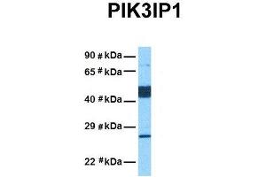 Host:  Rabbit  Target Name:  PIK3IP1  Sample Tissue:  Human Lung Tumor  Antibody Dilution:  1. (PIK3IP1 anticorps  (Middle Region))