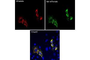 Immunofluorescence (IF) image for anti-tdTomato Fluorescent Protein (tdTomato) antibody (ABIN7273105) (tdTomato anticorps)