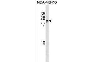 ZN Antibody (Center) (ABIN1538689 and ABIN2850066) western blot analysis in MDA-M cell line lysates (35 μg/lane). (ZNF580 anticorps  (AA 91-119))