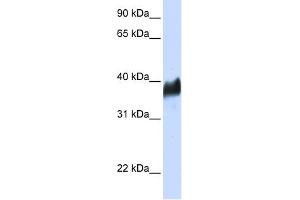 WB Suggested Anti-CLN8 Antibody Titration:  0. (CLN8 anticorps  (N-Term))