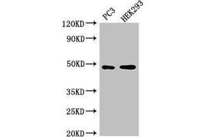 Western Blot Positive WB detected in: PC-3 whole cell lysate, HEK293 whole cell lysate All lanes: ACTR10 antibody at 3 μg/mL Secondary Goat polyclonal to rabbit IgG at 1/50000 dilution Predicted band size: 47 kDa Observed band size: 47 kDa (ACTR1 anticorps  (AA 165-417))
