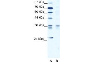WB Suggested Anti-BARX1 Antibody   Titration: 1. (BARX1 anticorps  (Middle Region))
