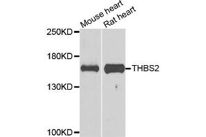 Western blot analysis of extracts of various cell lines, using THBS2 antibody. (Thrombospondin 2 anticorps)