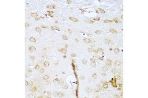 Immunohistochemistry of paraffin-embedded mouse brain using UBE2L3 antibody. (UBE2L3 anticorps  (AA 73-212))