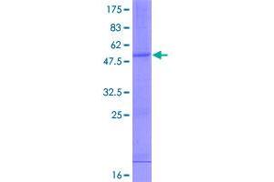Image no. 1 for Interferon, alpha 10 (IFNa10) (AA 1-189) protein (GST tag) (ABIN1307452)