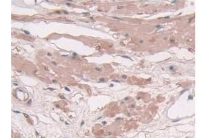 Detection of TAGLN in Human Prostate Tissue using Polyclonal Antibody to Transgelin (TAGLN) (Transgelin anticorps  (AA 1-201))