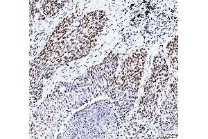 IHC analysis of HDAC2 using anti-HDAC2 antibody (ABIN7601564). (HDAC2 anticorps  (AA 387-488))