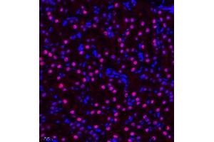 Immunofluorescence of paraffin embedded mouse kidney using ZHX3 (ABIN7076287) at dilution of 1:650 (400x lens) (ZHX3 anticorps)