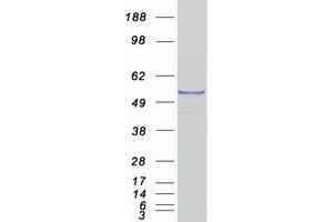 Validation with Western Blot