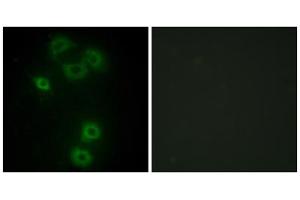 Immunofluorescence analysis of A549 cells, using BMX antibody. (BMX anticorps  (N-Term))