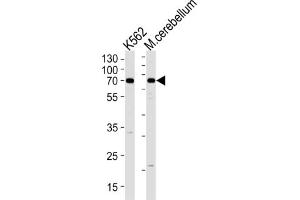 Western Blotting (WB) image for anti-EPM2A (Laforin) Interacting Protein 1 (EPM2AIP1) antibody (ABIN3004753)