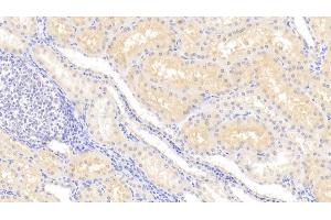 Detection of LCN12 in Human Kidney Tissue using Polyclonal Antibody to Lipocalin 12 (LCN12) (LCN12 anticorps  (AA 61-184))