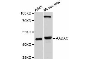 Western blot analysis of extracts of various cell lines, using AADAC antibody. (AADAC anticorps)