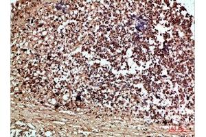 Immunohistochemical analysis of paraffin-embedded human-thyroid, antibody was diluted at 1:200