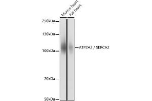Western blot analysis of extracts of various cell lines, using  / SERC antibody (ABIN3021429, ABIN3021430, ABIN3021431 and ABIN6215028) at 1:10000 dilution.