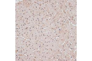 Immunohistochemistry of paraffin-embedded rat heart using TLK1 antibody (ABIN7270859) at dilution of 1:100 (40x lens).