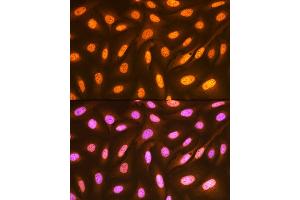 Immunofluorescence analysis of U-2 OS cells using FUBP1 Rabbit mAb (ABIN7267128) at dilution of 1:100 (40x lens). (FUBP1 anticorps)