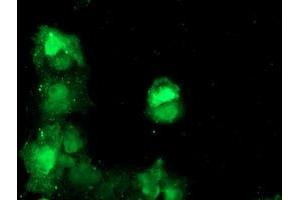 Anti-TBCC mouse monoclonal antibody (ABIN2455797) immunofluorescent staining of COS7 cells transiently transfected by pCMV6-ENTRY TBCC (RC203563). (TBCC anticorps)