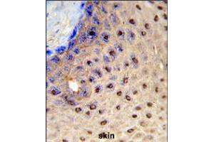 Formalin-fixed and paraffin-embedded human skin reacted with PAX3 Antibody (N-term), which was peroxidase-conjugated to the secondary antibody, followed by DAB staining. (Paired Box 3 anticorps  (N-Term))