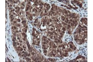 Image no. 1 for anti-Proteasome Subunit alpha 6 (PSMA6) antibody (ABIN1500465)