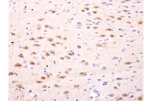 IHC-P Image Islet 1 antibody detects Islet 1 protein at nucleus on rat fore brain by immunohistochemical analysis.