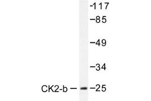 Image no. 1 for anti-Casein Kinase 2, beta (CSNK2B) antibody (ABIN272014) (CSNK2B anticorps)