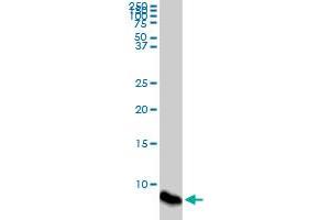 ATOX1 monoclonal antibody (M08), clone 4D6. (ATOX1 anticorps  (AA 1-68))