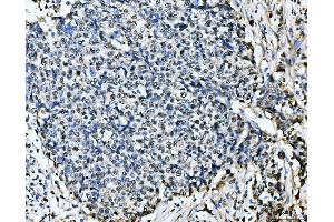 IHC analysis of MCM6 using anti-MCM6 antibody (ABIN7600038).