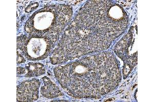 IHC analysis of Aconitase 2 using anti-Aconitase 2 antibody (ABIN7602770). (ACO2 anticorps  (C-Term))