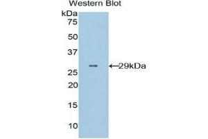 Western Blotting (WB) image for anti-CD36 (CD36) (AA 91-311) antibody (ABIN1859048) (CD36 anticorps  (AA 91-311))