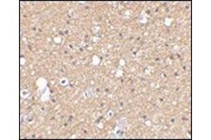 Immunohistochemical staining of human brain tissue using AP30785PU-N SIRT2 antibody at 2. (SIRT2 anticorps  (C-Term))