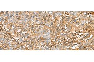 Immunohistochemistry of paraffin-embedded Human tonsil tissue using LGALS9 Polyclonal Antibody at dilution of 1:40(x200) (Galectin 9 anticorps)