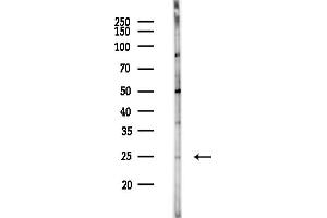 anti-MIS12, MIND Kinetochore Complex Component, Homolog (MIS12) (Internal Region) antibody