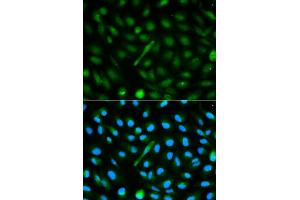 Immunofluorescence analysis of MCF-7 cells using AHSG antibody. (Fetuin A anticorps)