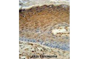 Immunohistochemistry (IHC) image for anti-Adenylate Kinase 7 (AK7) antibody (ABIN3002976)