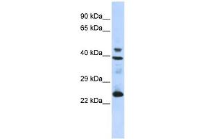 SEPP1 antibody used at 1 ug/ml to detect target protein. (Selenoprotein P anticorps  (N-Term))