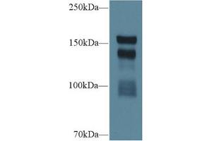 Western blot analysis of Rat Serum, using Rat THBS1 Antibody (1 µg/ml) and HRP-conjugated Goat Anti-Rabbit antibody ( (Thrombospondin 1 anticorps  (AA 511-670))