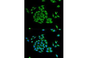 Immunofluorescence analysis of HeLa cell using PICK1 antibody. (PICK1 anticorps  (AA 260-360))