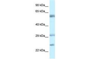 anti-V-Set and Immunoglobulin Domain Containing 10 (VSIG10) (AA 107-156) antibody